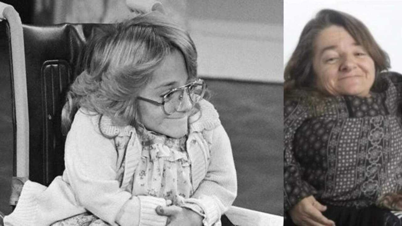 Cam kemik hastalığıyla tanınan o