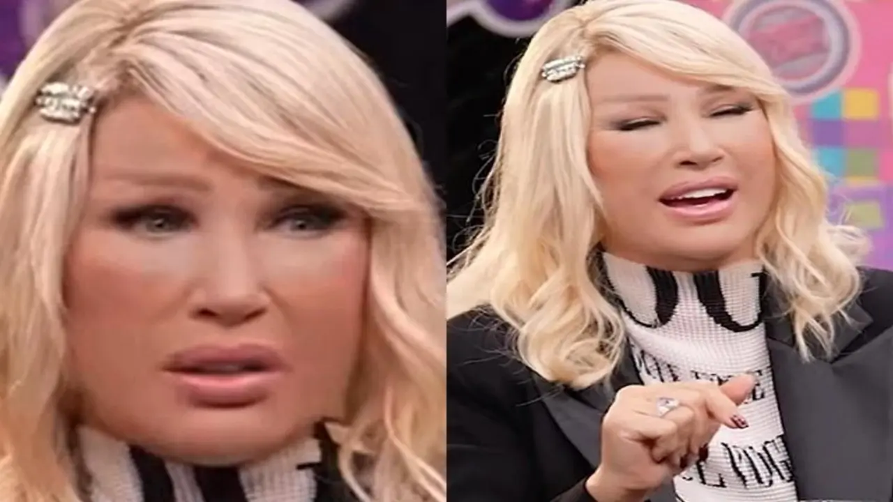 Yüzündeki şişlik dikkat çekmişti