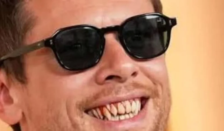 Jack O’Connell 2026 Oscar Gecesinde Dişleriyle Viral Oldu!