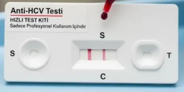Virus-Taramasi-Rehberi-Nedir-Nasil-Uygulanir-ve-Neden-Onemlidir-featured