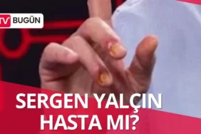 Sergen Yalçın'ın Parmakları Neden Farklı Görünüyor, Hasta mı _20260624_002752_0000